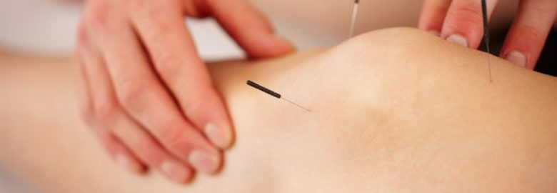 Feel Well Acupuncture