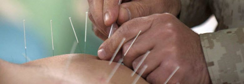 Jing Japanese Acupuncture