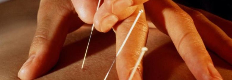 Eastern Traditions Acupuncture