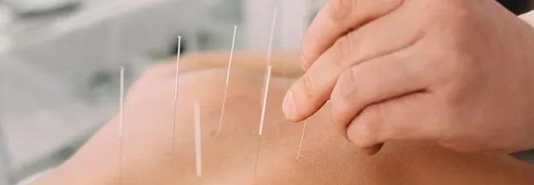 Lee's Acupuncture