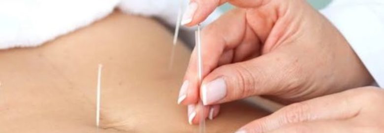 Healing Source Acupuncture