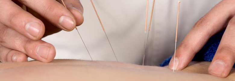 Lynott Chiropractic & Acupuncture