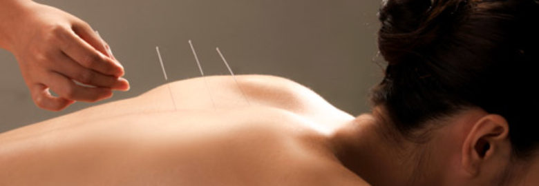 A Plus Acupuncture