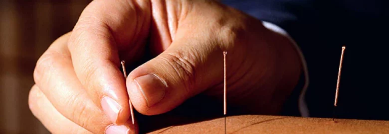 10 body type Acupuncture Clinic