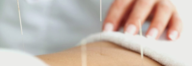 Aiki Acupuncture