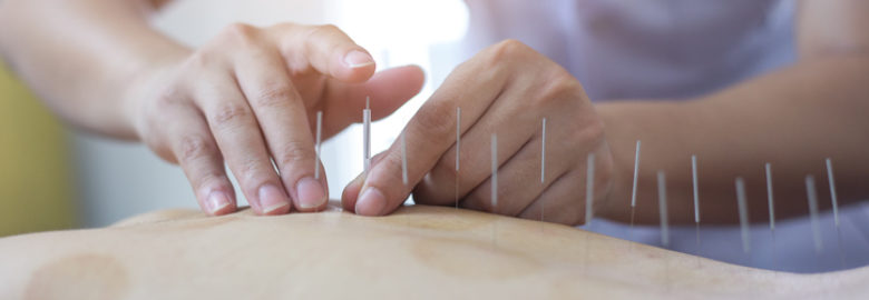 Above & Beyond Acupuncture
