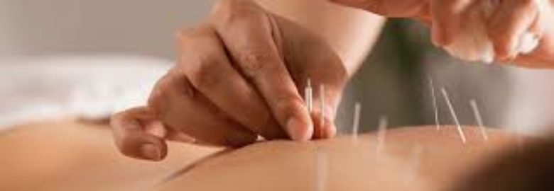 Dainty Acupuncture