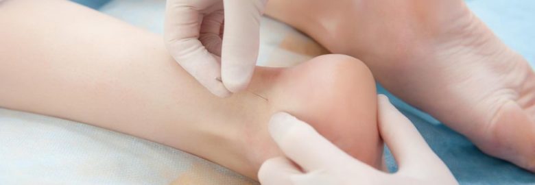 Avicenna Acupuncture