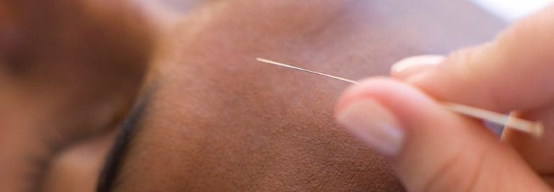 Motion Chiropractic and Acupuncture