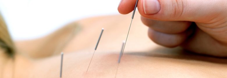 Cape Coral Acupuncture Clinic