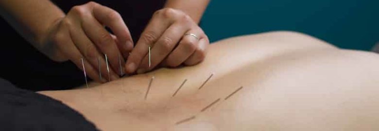 Steve Phillips Acupuncture Clinic