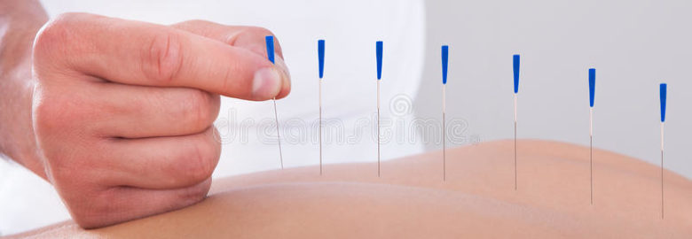 Kane Acupuncture