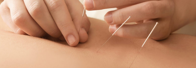 Bouchard Wellness Acupuncture