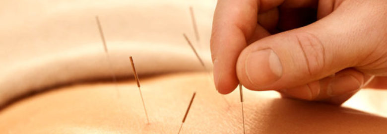 Ancient Arts Acupuncture