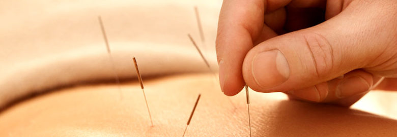 Preston Royal Acupuncture Clinic