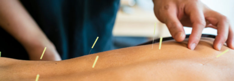 Vicky Lee Acupuncture