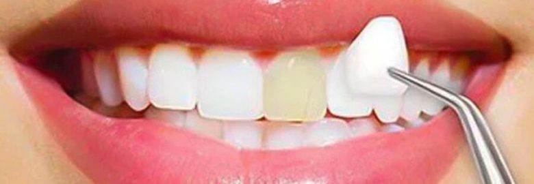 Creative Smiles Dentistry