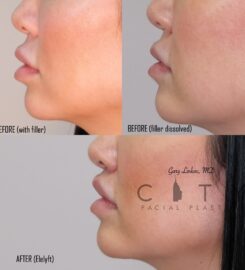 City Facial Plastics