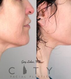 City Facial Plastics