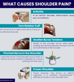 Physical Therapists NYC