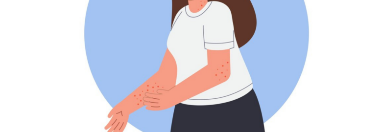 Onco Health Mart: Your Source for Quality Anti-Fungal Medicines Online