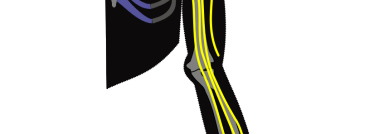 Brachial Plexus Hospital in India