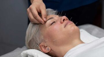 Dr Yang Acupuncture