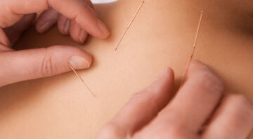 Barrhaven Chinese Acupuncture Clinic