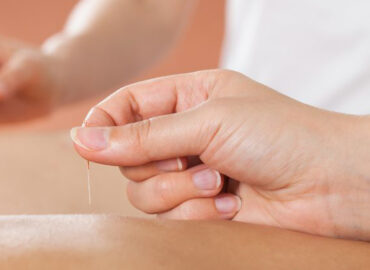 Barrhaven Chinese Acupuncture Clinic