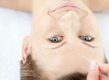 Barrhaven Chinese Acupuncture Clinic